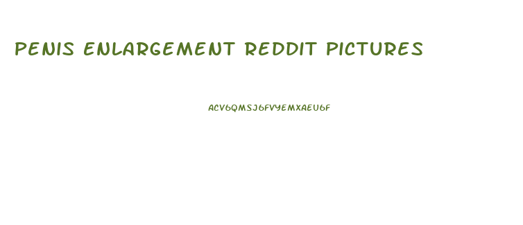Penis Enlargement Reddit Pictures