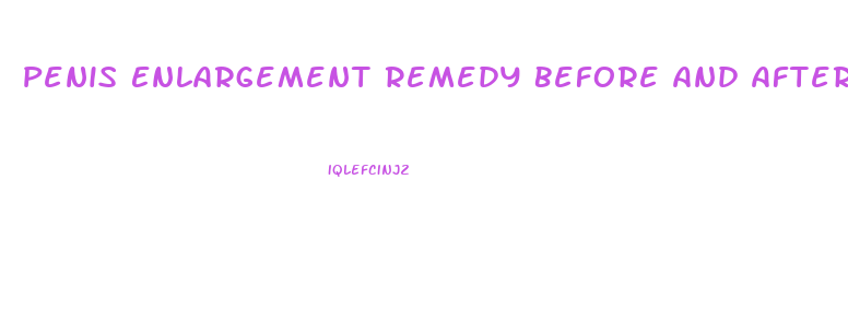 Penis Enlargement Remedy Before And After Results