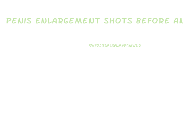 Penis Enlargement Shots Before And After
