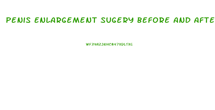 Penis Enlargement Sugery Before And After