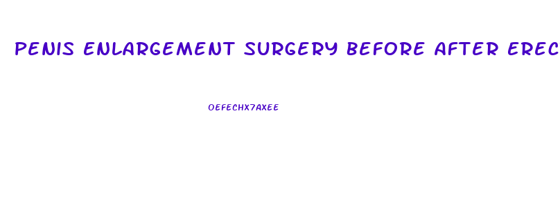 Penis Enlargement Surgery Before After Erect