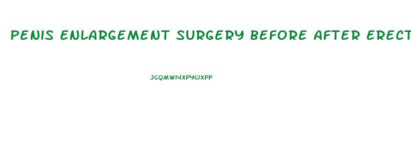 Penis Enlargement Surgery Before After Erect