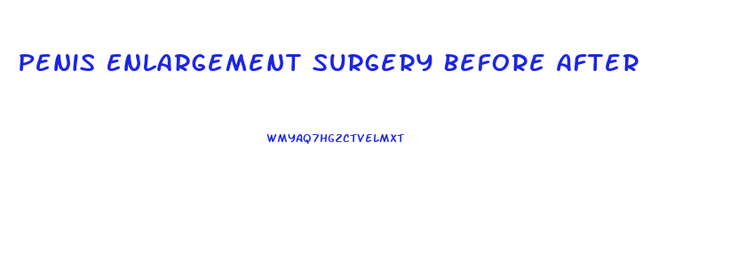 Penis Enlargement Surgery Before After