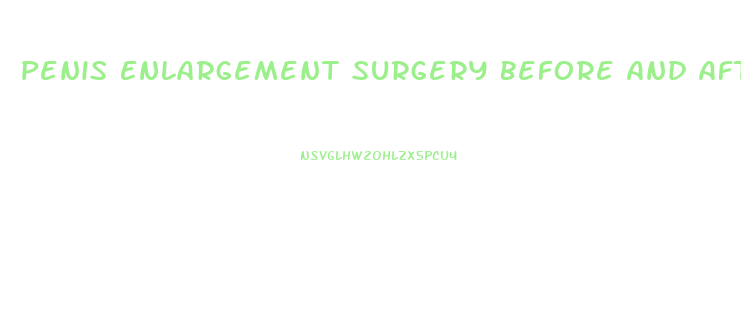 Penis Enlargement Surgery Before And After