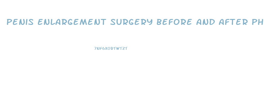 Penis Enlargement Surgery Before And After Photos