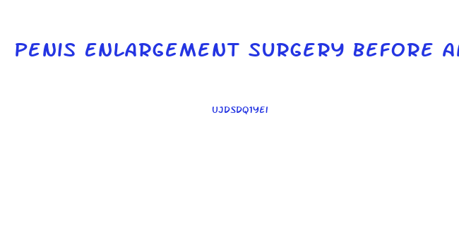 Penis Enlargement Surgery Before And Aftrt