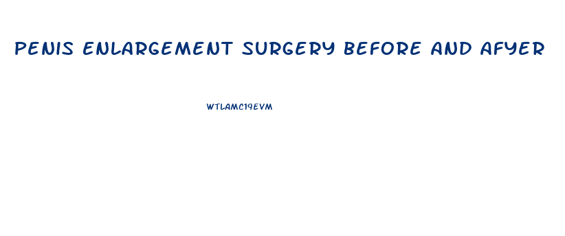 Penis Enlargement Surgery Before And Afyer