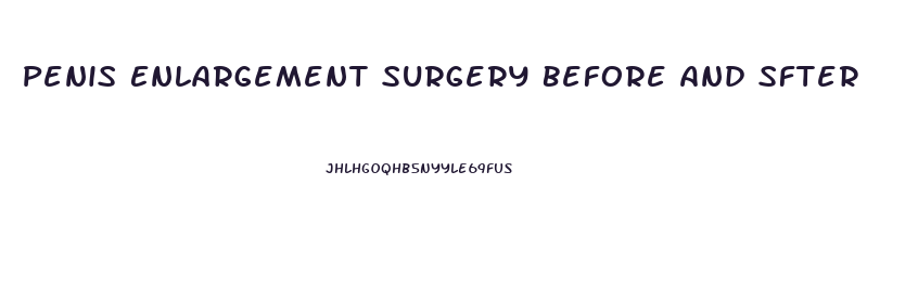 Penis Enlargement Surgery Before And Sfter