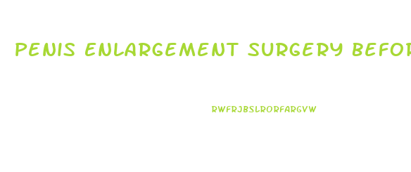 Penis Enlargement Surgery Before