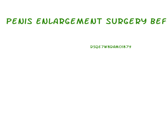 Penis Enlargement Surgery Before Snd After