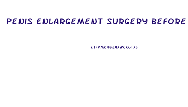 Penis Enlargement Surgery Before Snd After
