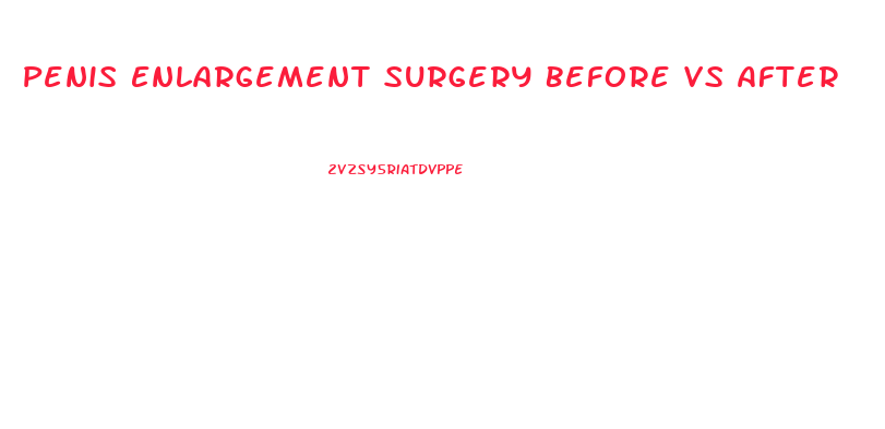 Penis Enlargement Surgery Before Vs After