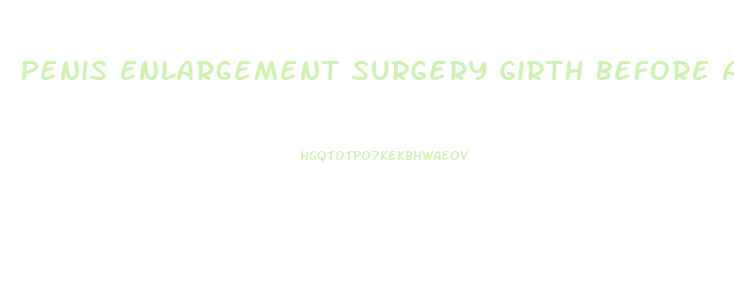 Penis Enlargement Surgery Girth Before And After Erect