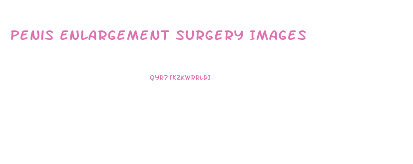 Penis Enlargement Surgery Images