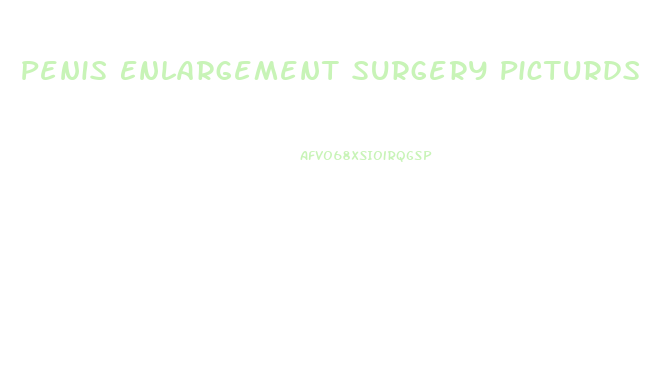 Penis Enlargement Surgery Picturds