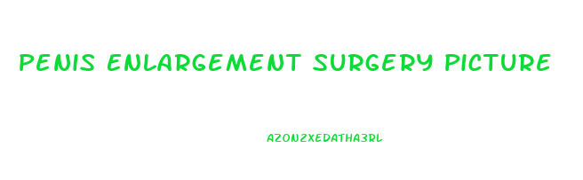 Penis Enlargement Surgery Picture
