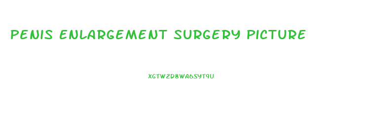 Penis Enlargement Surgery Picture