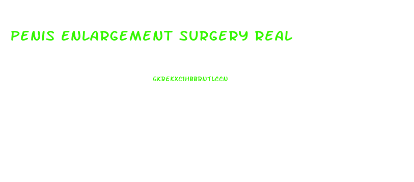 Penis Enlargement Surgery Real
