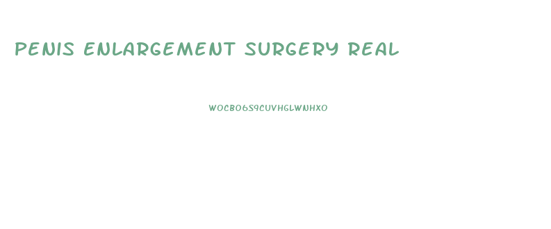 Penis Enlargement Surgery Real