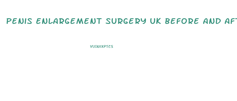 Penis Enlargement Surgery Uk Before And After