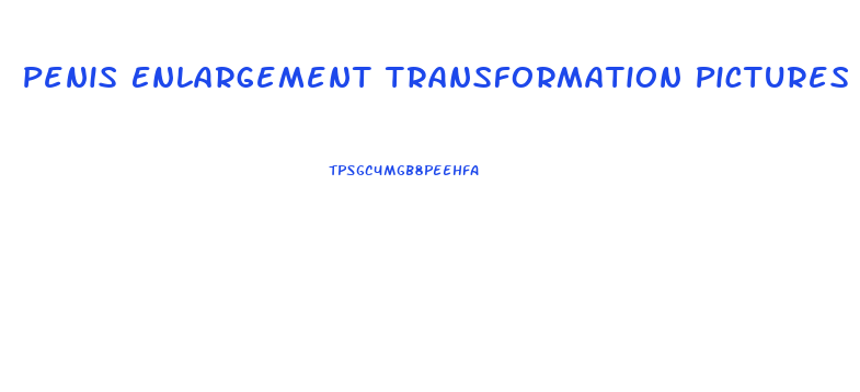 Penis Enlargement Transformation Pictures