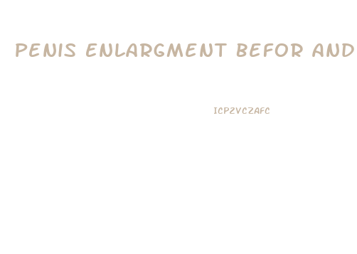 Penis Enlargment Befor And After