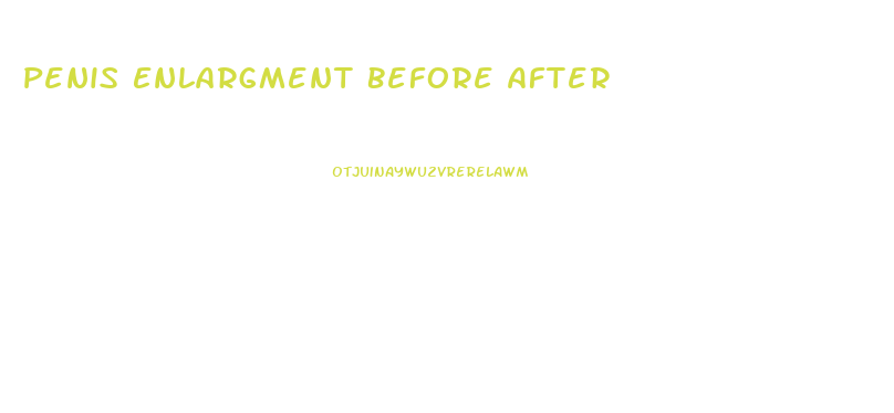 Penis Enlargment Before After