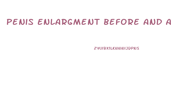 Penis Enlargment Before And After