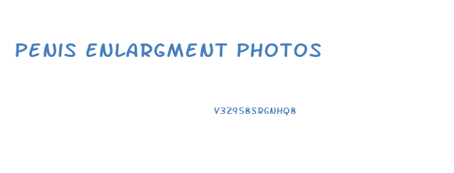 Penis Enlargment Photos
