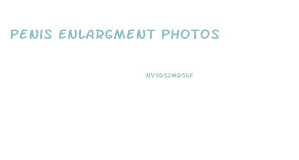 Penis Enlargment Photos