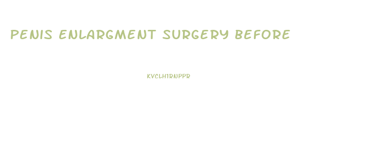 Penis Enlargment Surgery Before