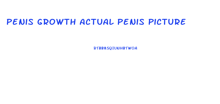 Penis Growth Actual Penis Picture