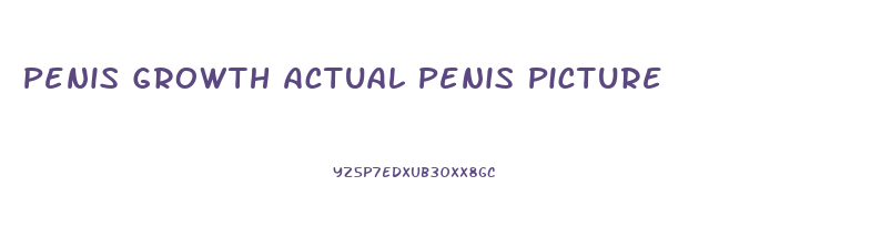 Penis Growth Actual Penis Picture