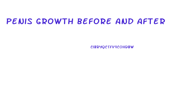 Penis Growth Before And After