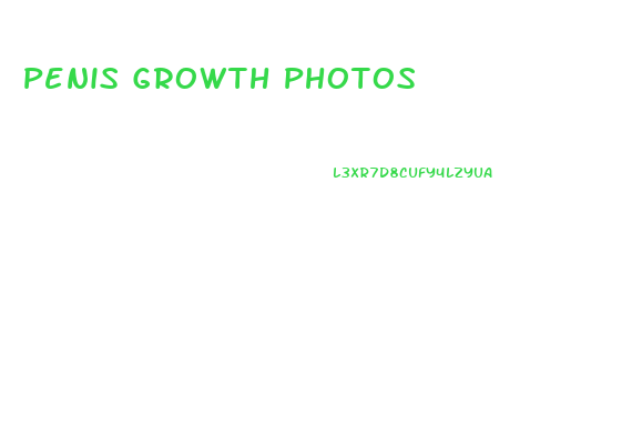 Penis Growth Photos