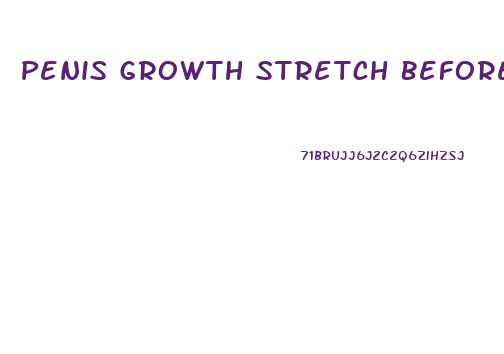 Penis Growth Stretch Before And After