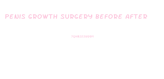 Penis Growth Surgery Before After