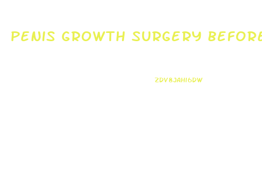 Penis Growth Surgery Before After