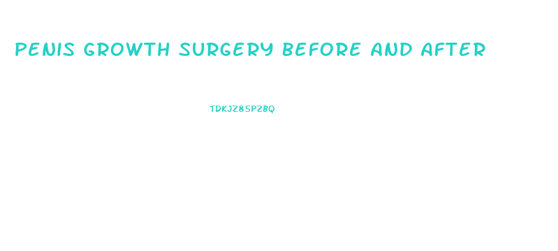 Penis Growth Surgery Before And After