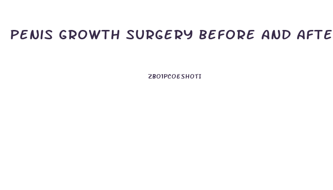 Penis Growth Surgery Before And After