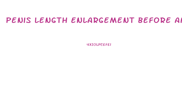 Penis Length Enlargement Before And After