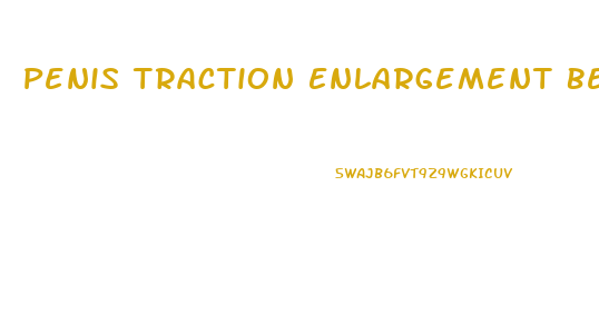 Penis Traction Enlargement Before And After