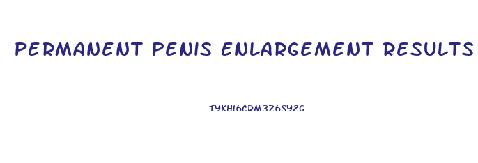 Permanent Penis Enlargement Results