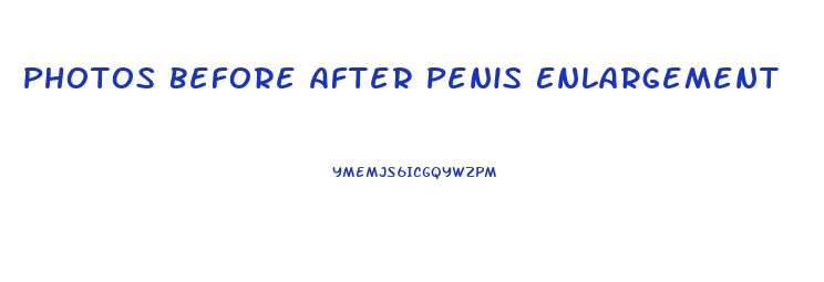 Photos Before After Penis Enlargement