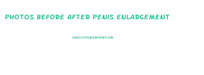 Photos Before After Penis Enlargement