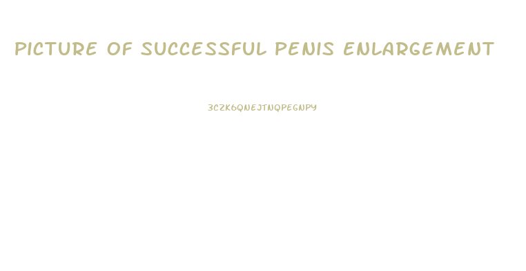 Picture Of Successful Penis Enlargement