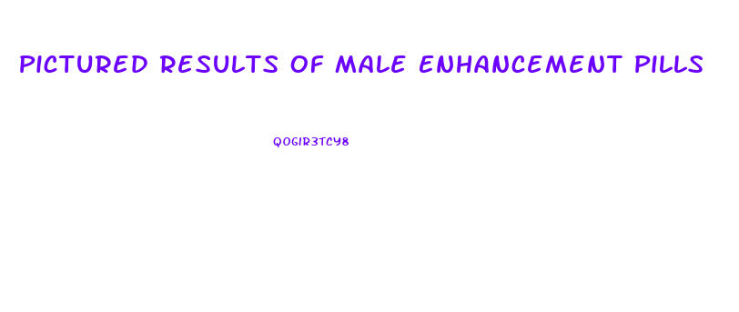 Pictured Results Of Male Enhancement Pills