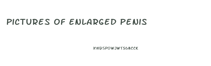 Pictures Of Enlarged Penis