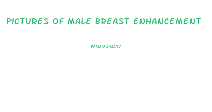 Pictures Of Male Breast Enhancement