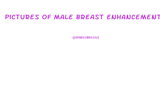Pictures Of Male Breast Enhancement